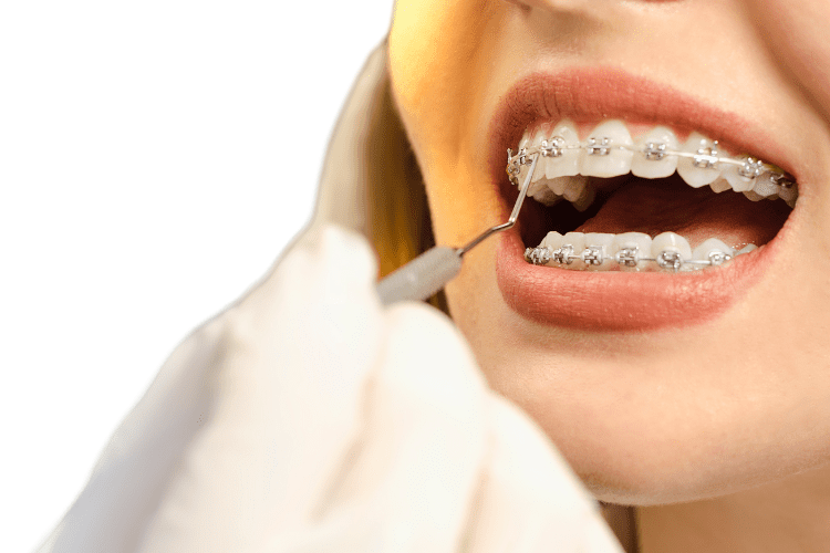 ortodontie dentara