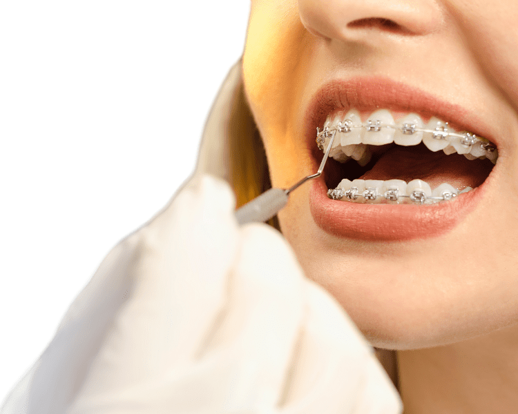 ortodontie dentara